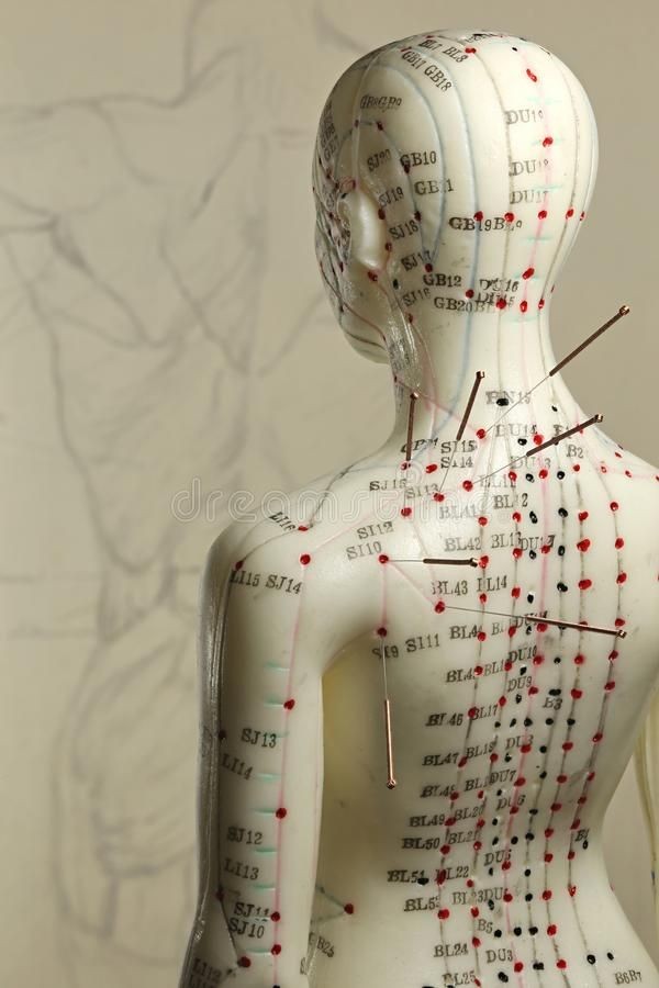 Pacess Acupuncture Academy Kannur